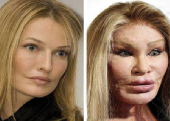 النجوم وعمليات التجميل