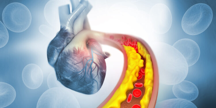 عندما يرتفع الكولسترول… ماذا تفعل؟