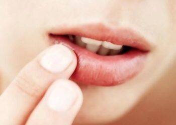 ‫جفاف الشفاه.. أكثر من مجرد مشكلة جمالية‬