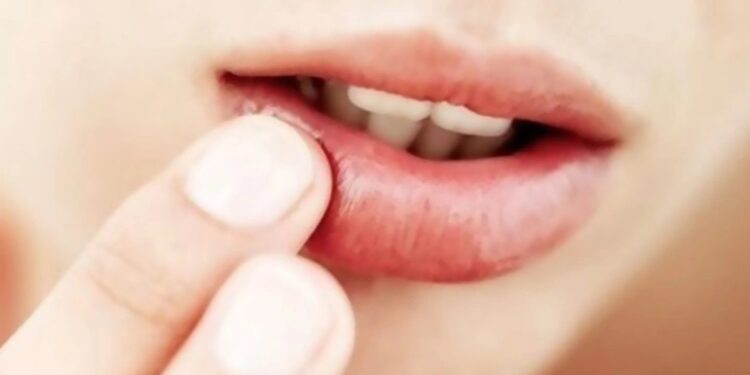 جفاف الشفاه.. أكثر من مجرد مشكلة جمالية