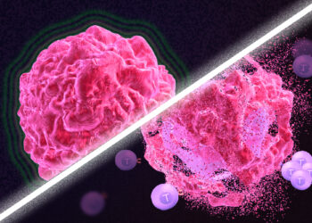 طرق جديدة لعلاج السرطان الحاد