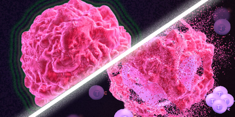 طرق جديدة لعلاج السرطان الحاد