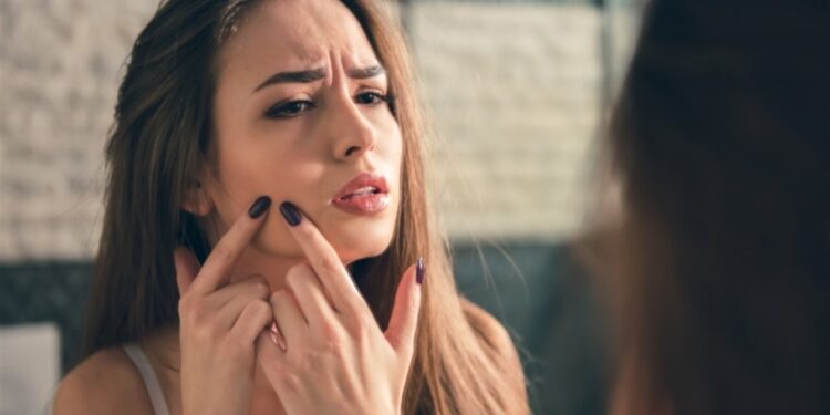 نصائح تحميكم من ظهور حب الشباب!