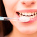 تنظيف الأسنان قد يجنبكم التهاب المفاصل
